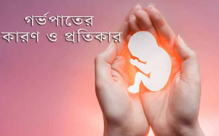 Causes-and-remedies-for-miscarriage