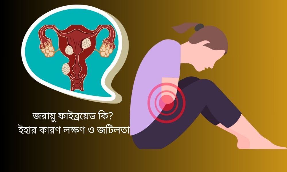 Uterine fibroids-Homeoshifa